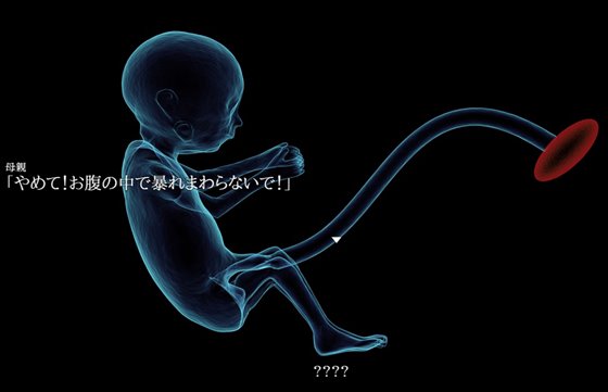 私は彼の肢体をゴミ箱に突っ込みたい